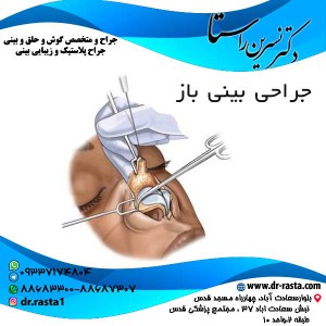جراحی بینی باز